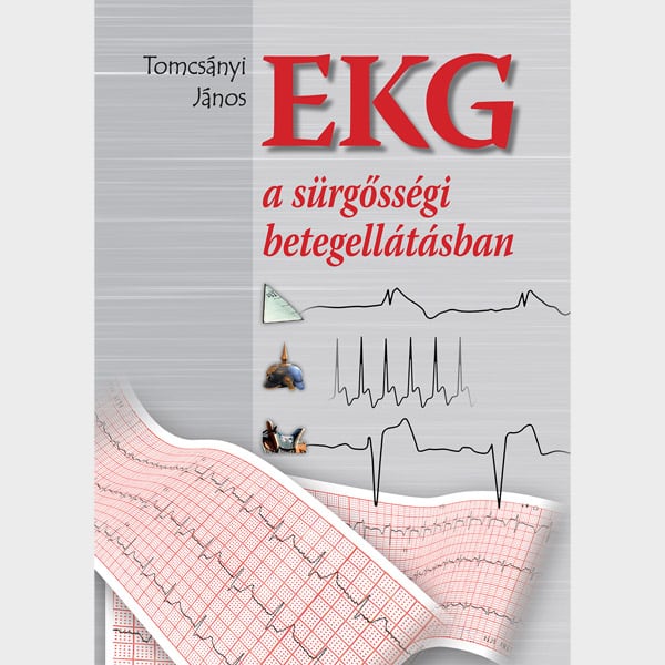 EKG a sürgősségi betegellátásban