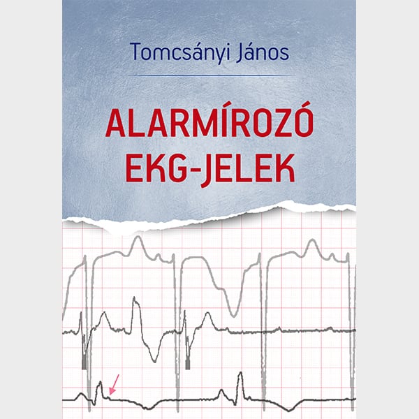 Alarmirozo-EKG-jelek